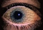 Essentiële vetzuren tegen droge ogen