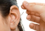 Ooracupunctuur vermindert hoofdpijn direct