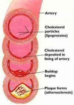 Wat is Cholesterol?