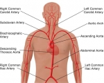 Effect van curcumine op aorta-arteriosclerose