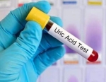 De gevaren van urinezuur