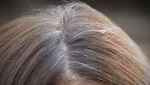 Hoe voorkom je grijze haren?